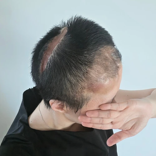 프로필 이미지